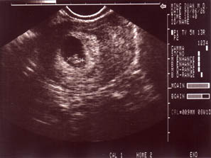 ultrasound1