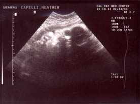 ultrasound2